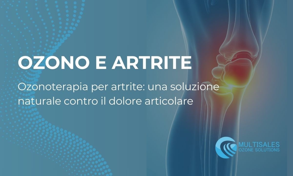 Ozonoterapia per artrite: Un trattamento naturale